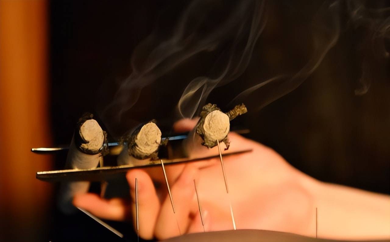 艾灸时,切记注意3点_相关_方式_操作