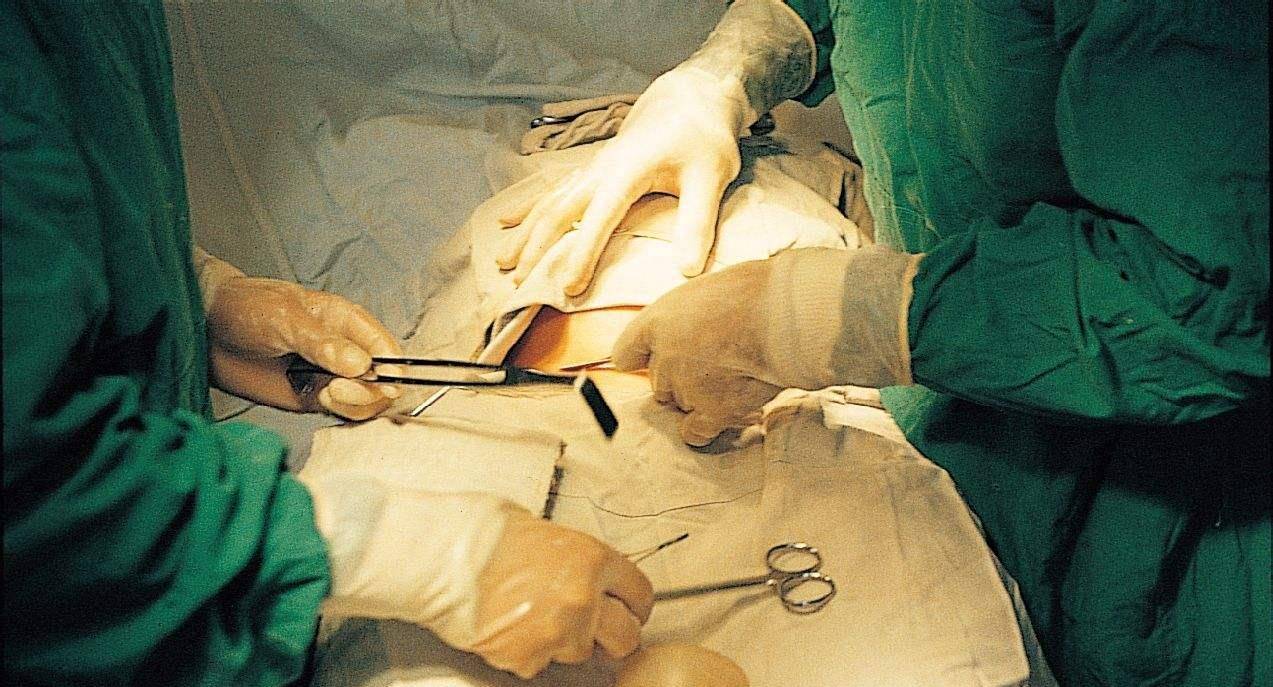 头胎顺,二胎剖,宝妈用亲身经历告诉你,顺产与剖腹产之间的区别_剖宫产