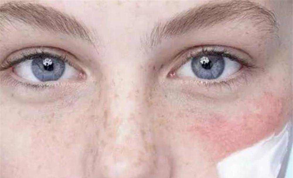 脆弱的"敏感肌"能化妆吗?遮盖和修复选谁好?