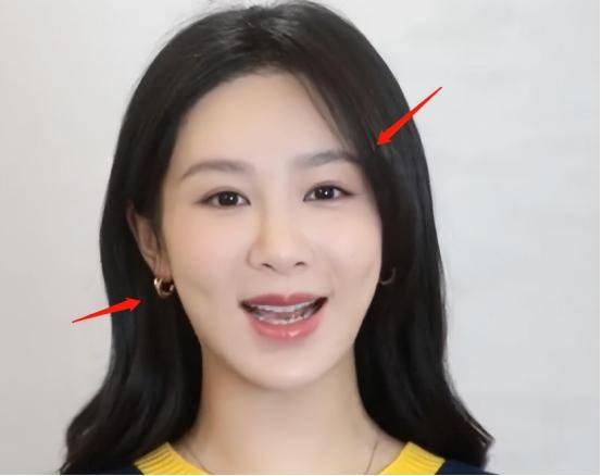 杨紫近照再惹争议!