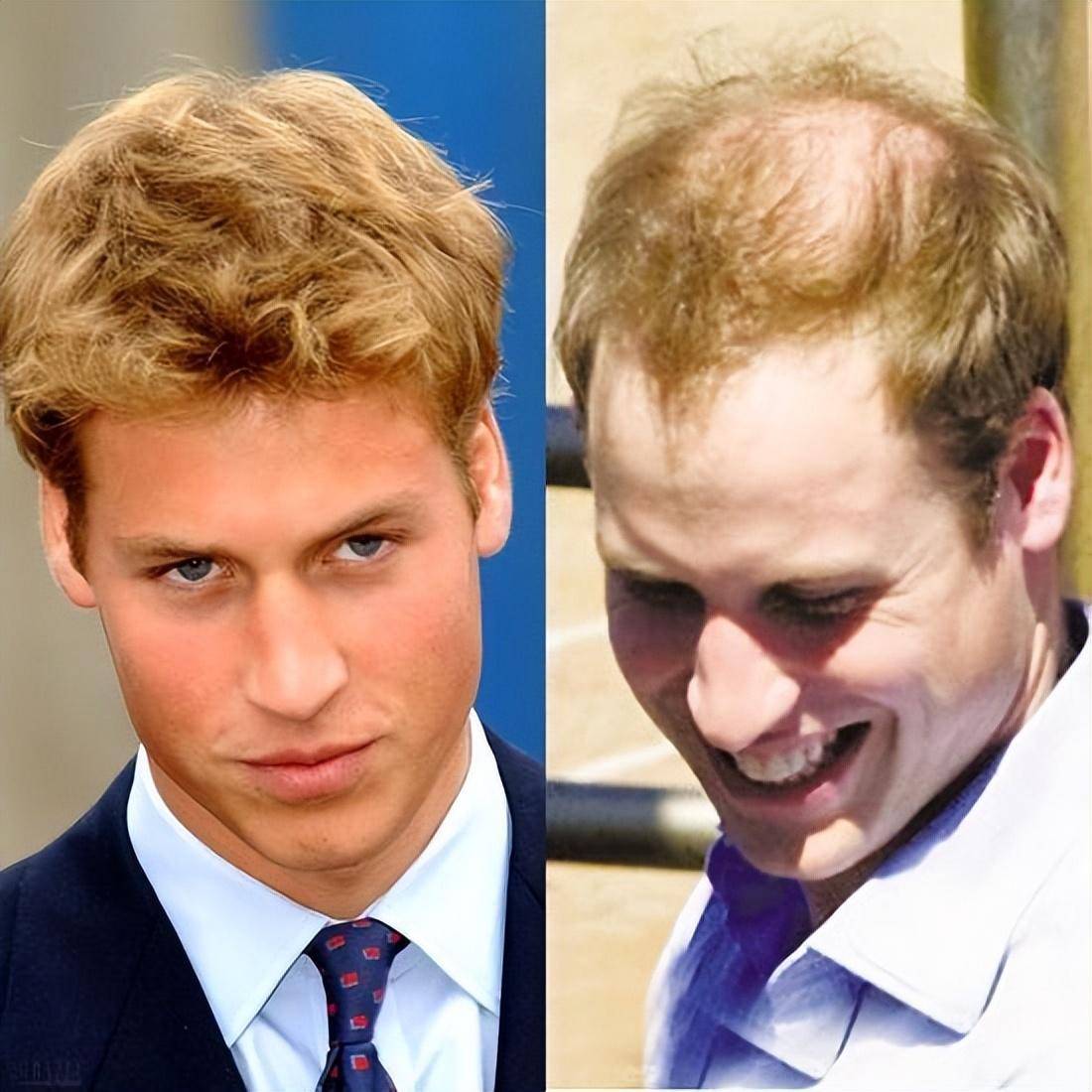 国外王室的强大基因,查尔斯秃头,安妮公主龅牙,唯有孙辈才好看_菲利普