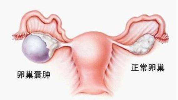 这5种所谓的＂妇科病＂,其实都不是病,别再害怕了