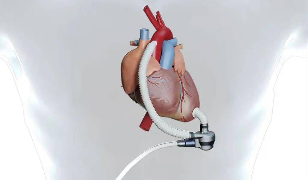 人造心脏电池图片