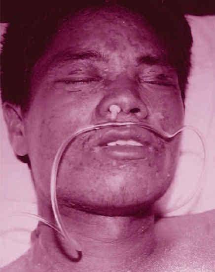 1人葬送生命,43人受到伤害_李贵珍_毕师傅_芥子气