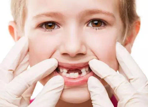 换牙期要注意哪些问题(日常如何护理牙齿)