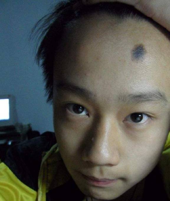 痣相算命:脸上胎记解读人生运势,哪些胎记对运势有帮助?_额头_方面_感