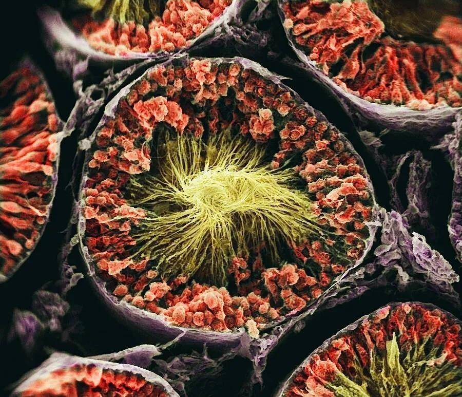 放大 1,000 倍恶性肿瘤细胞的电子显微镜图像人眼的特写视图红细胞被
