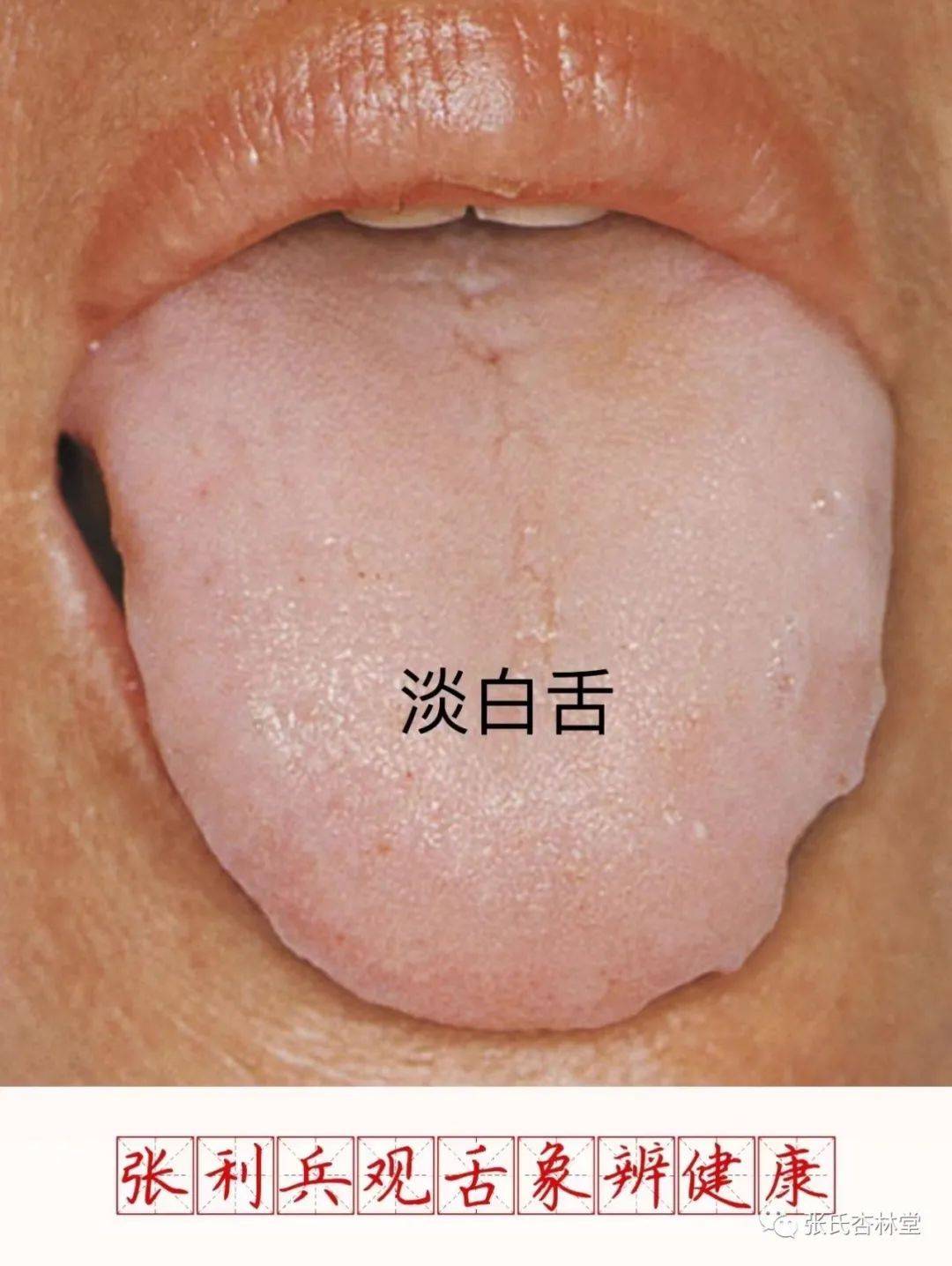 舌头背面正常颜色图片