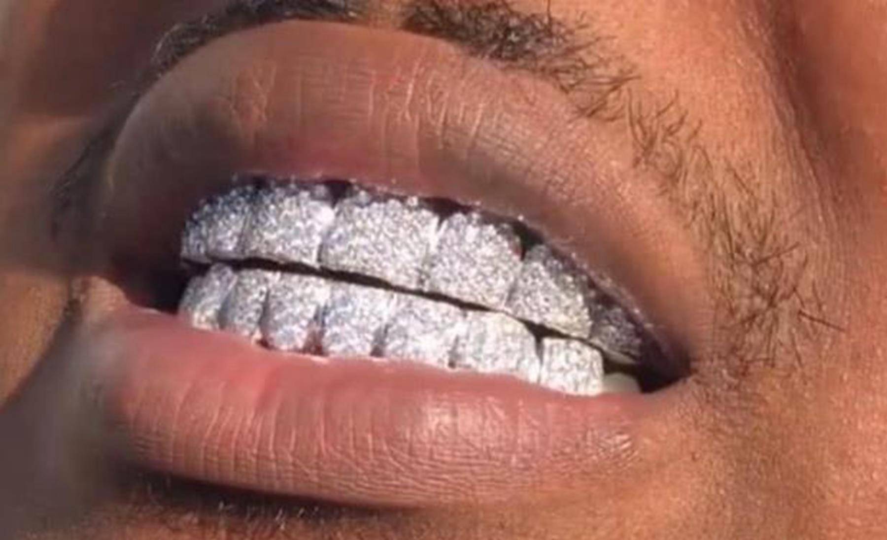 富二代被绑匪折磨14小时,2亿钻石牙被硬生生拔光_牙齿_低调_生活