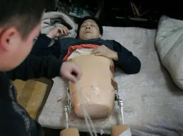 彭水林被货车"削"成78厘米,妻子不离不弃,如今当上老板_医生_手术