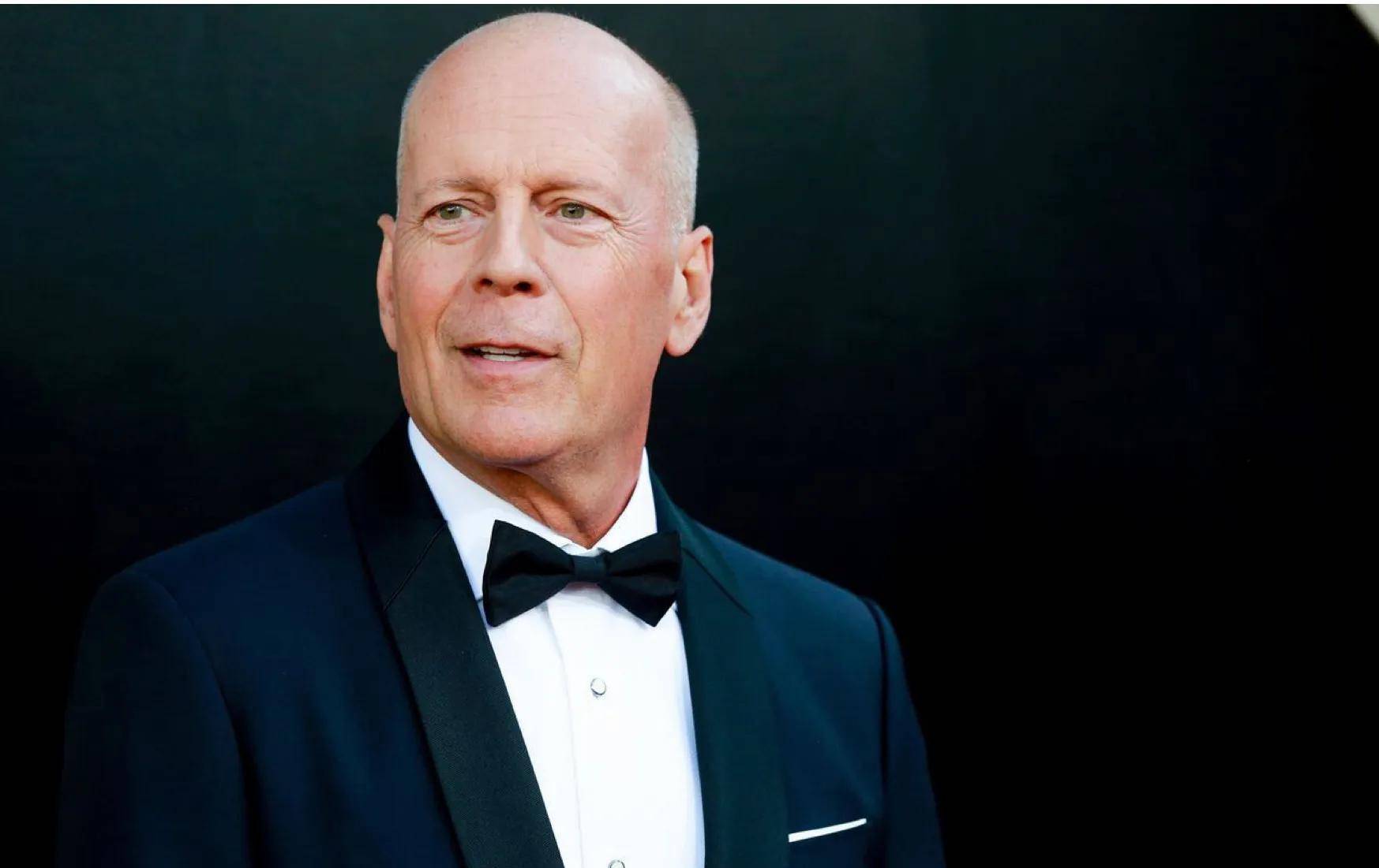 die hardbruce willis布鲁斯·威利斯被诊断出患有额颞痴呆症_方法