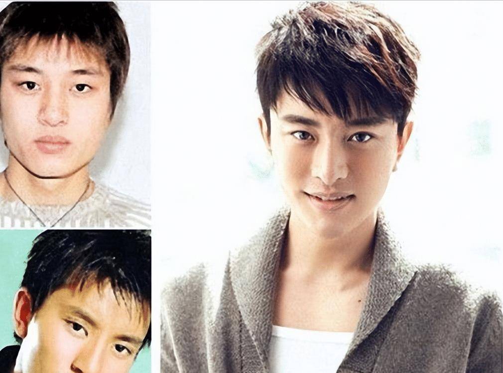 在刚出道没多久,就有人爆出贾乃亮整容.