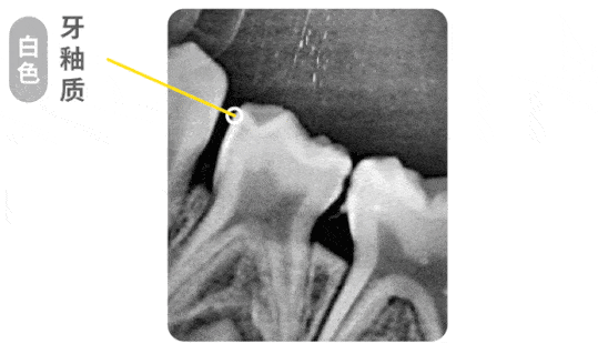 家长们一定要注意!_牙齿_进行_口腔