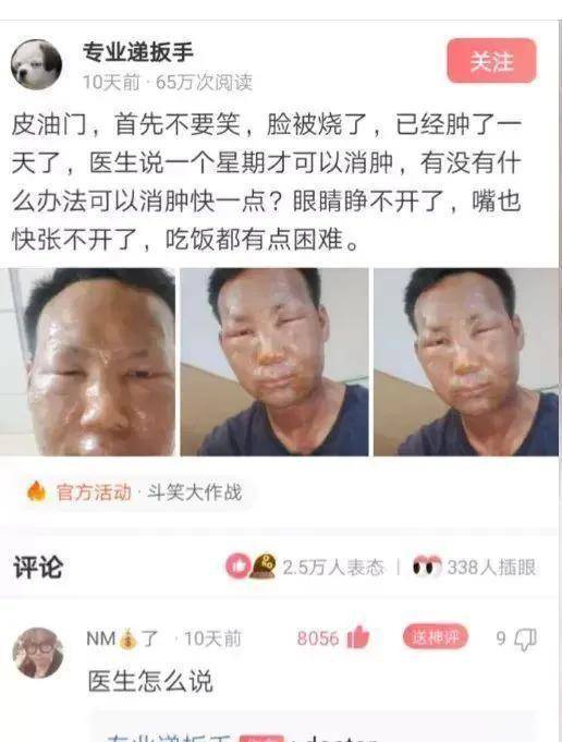 神回复：公公陪我儿子输液，医生给我发的照片！那是啥情况？