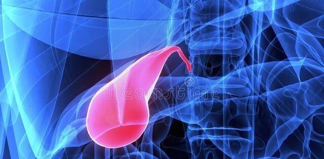 悄无声息的"胆囊癌",从不吃早饭开始!