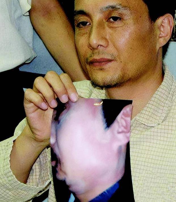 一个骑在王伯昭身上挥巴掌,一个站在身旁拳打脚踢,"江别鹤"王伯昭为了