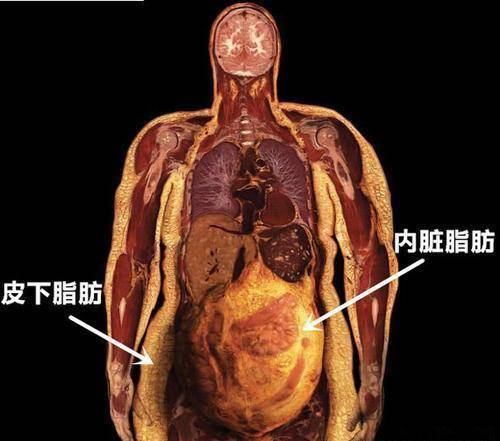 可能是4个原因造成的