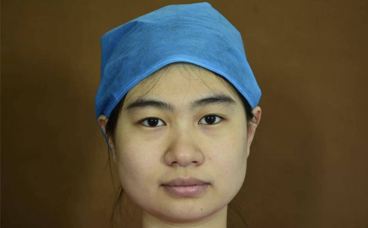 倭瓜脸很少见,希望你没有_面部_化妆_整体