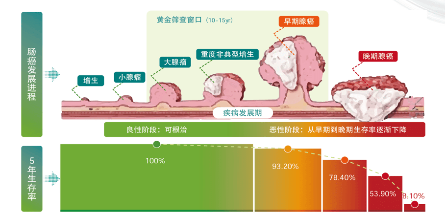 2019年直肠癌tnm分期图图片