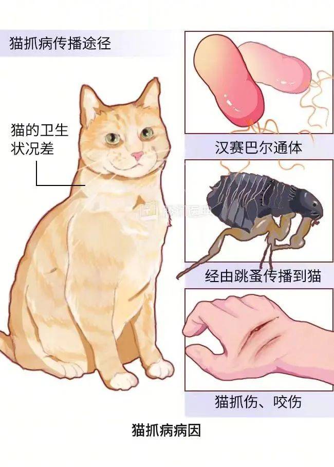 图源:腾讯医典不过,大家可以放心:猫抓病不会"人传人".