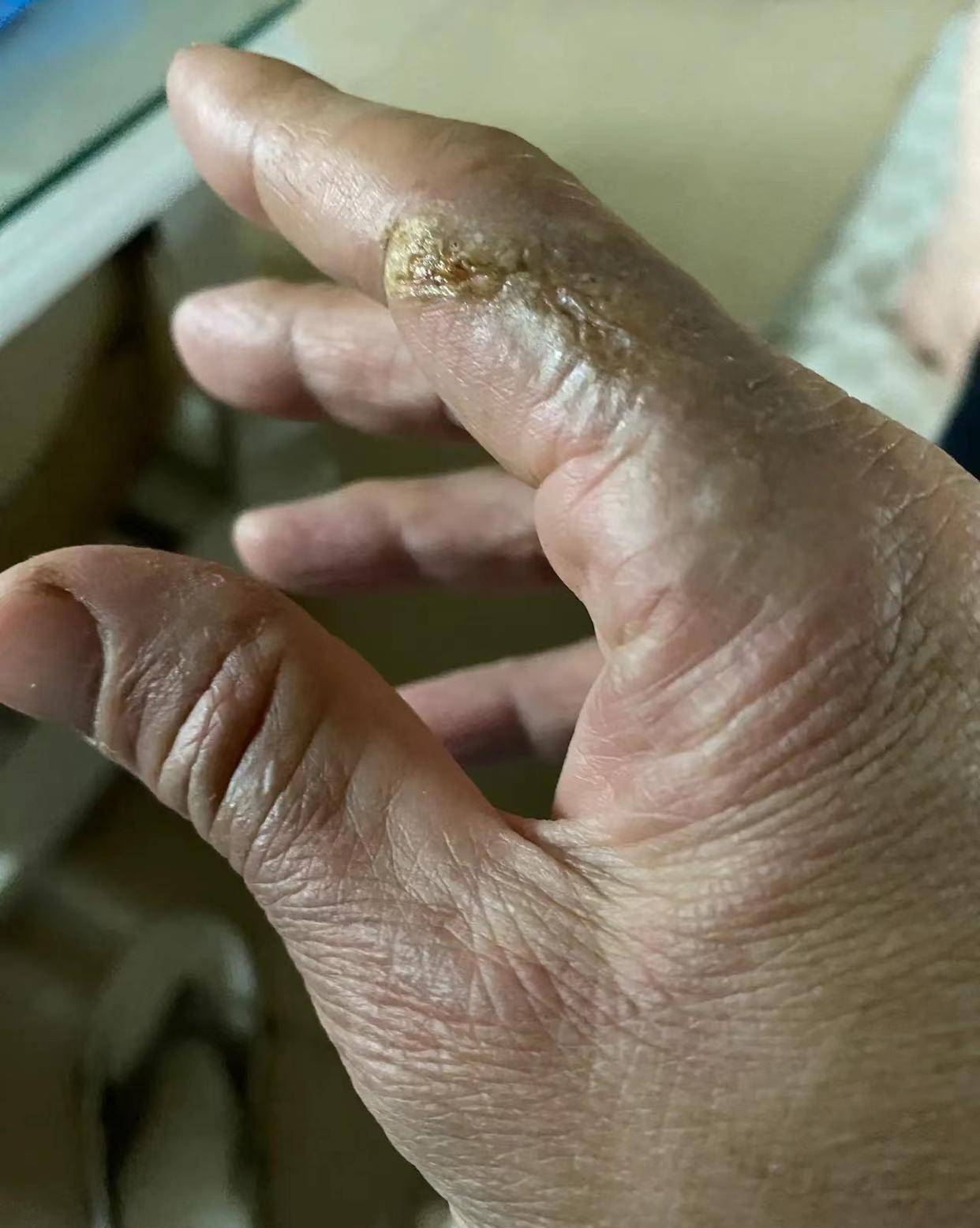 又一名钓友触电身亡,钓鱼触电为何频发?