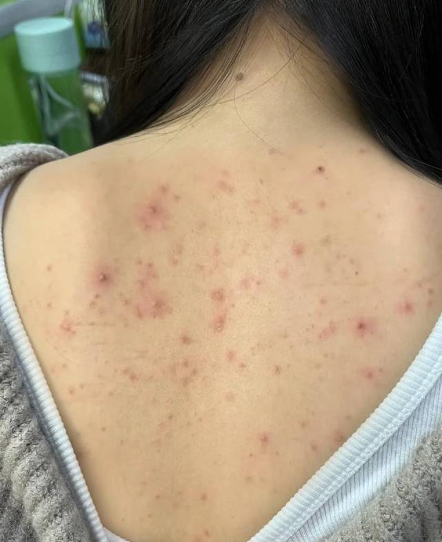 参考_情况_效果