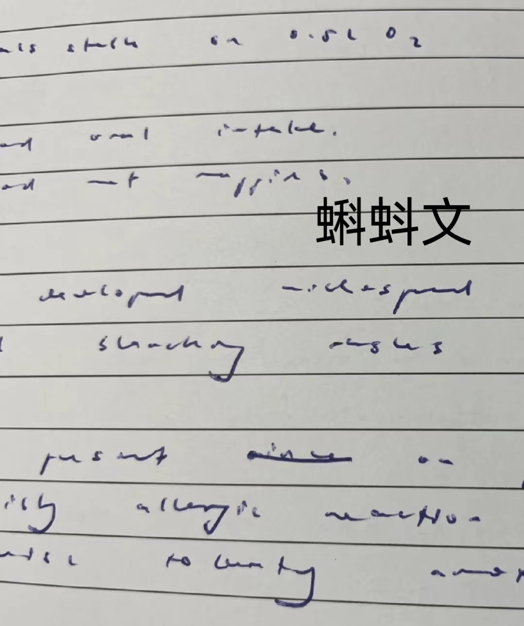 “赵今麦”字体已过时，“医生字体”被学生膜拜，蝌蚪文谁能懂啊(赵今麦的字)