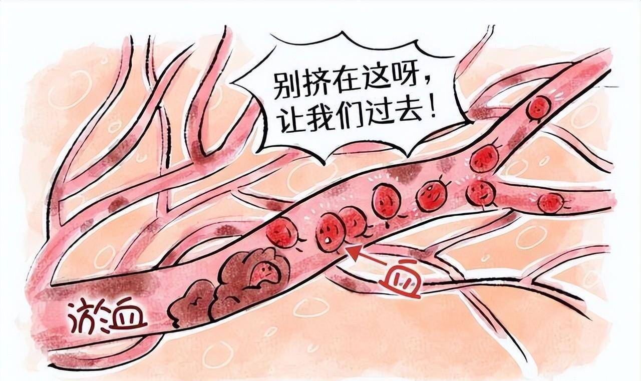 百病,中医送你两味药,化痰散瘀,消结节,消除全身包块_流通_淤血_血液