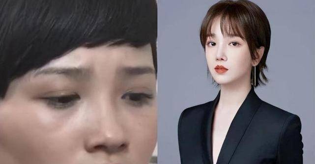 这8位"换头改命"的女星:杨颖成顶流,熊黛林嫁富豪_金晨_baby_发展