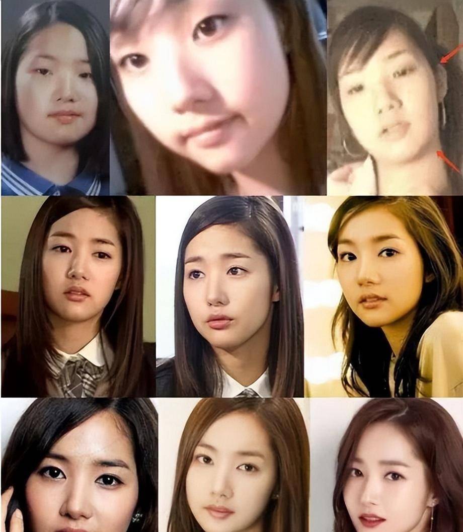 整过容的韩国女星,有的堪称整容模板,看完你还相信美女吗?