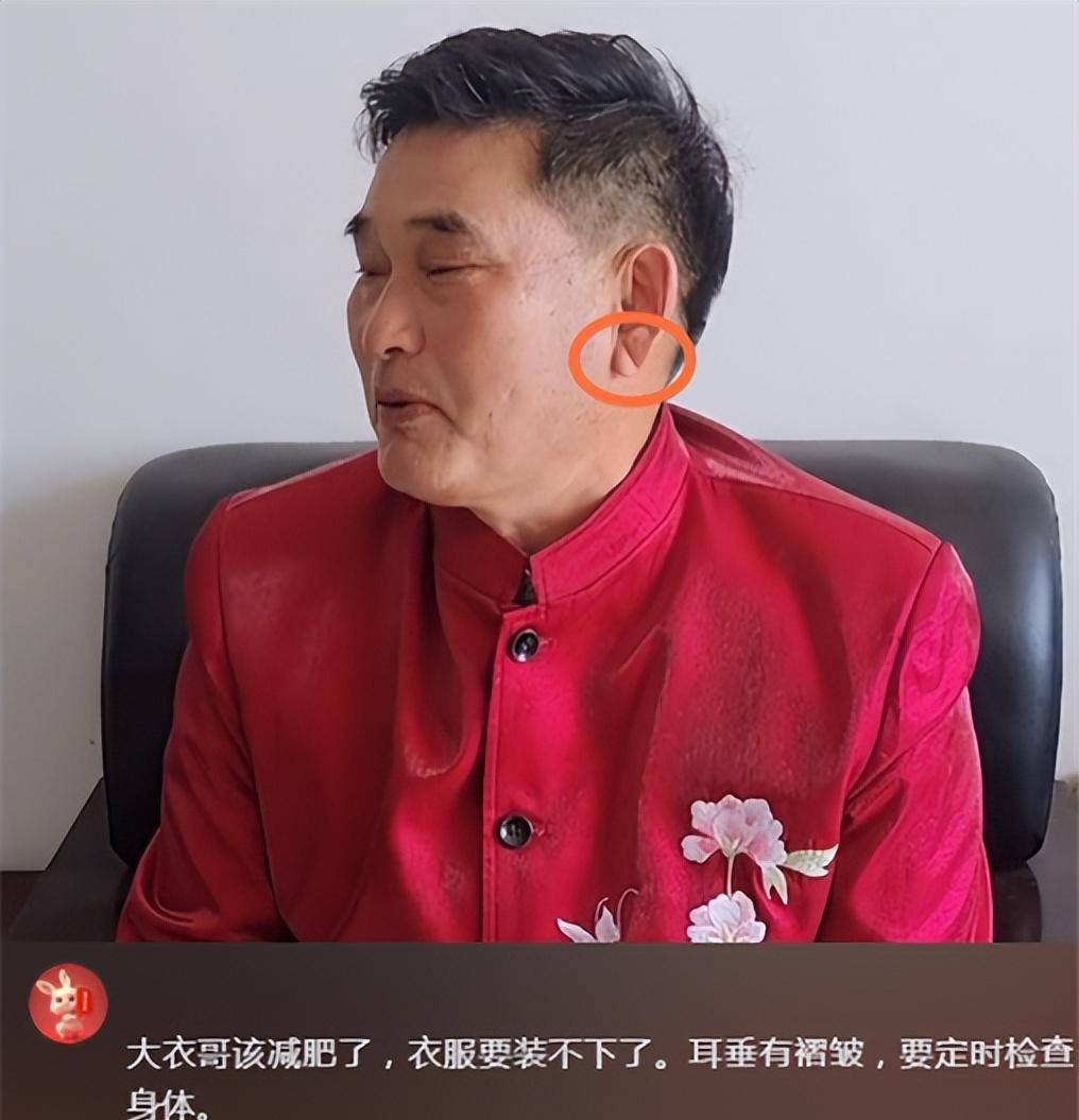皮球大的肚子努力挣钱,耳垂有褶皱,被劝及时就医_朱小伟_问题_检查