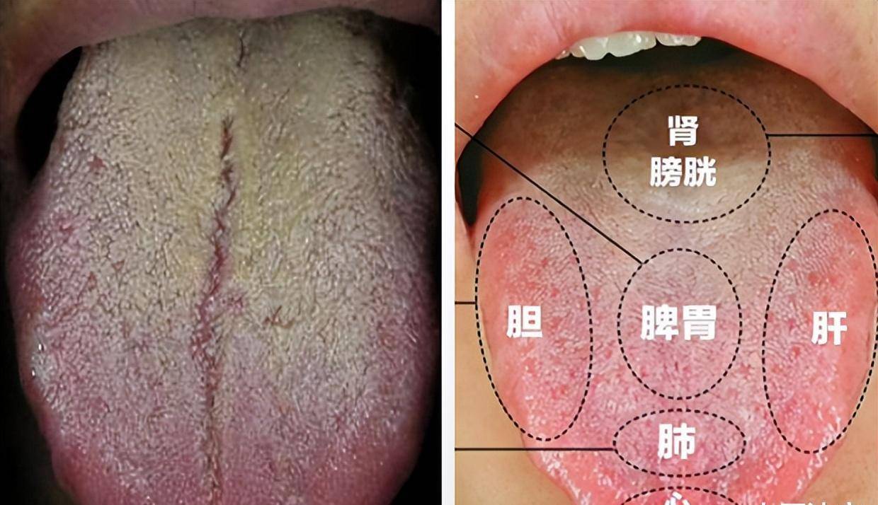 蜈蚣丸舌头发黑图片