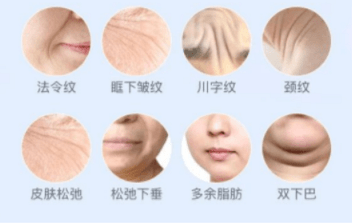 一次说明白：超声炮多久做一次，一次维持多久，多少钱一次？-超声炮多久有效果最佳