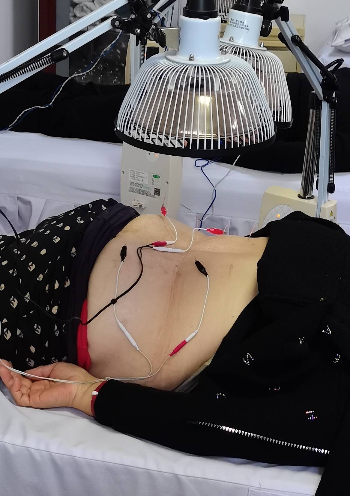 当然我们也并不反对用电针疗法,在用电针疗法的同时我们要时刻将古人