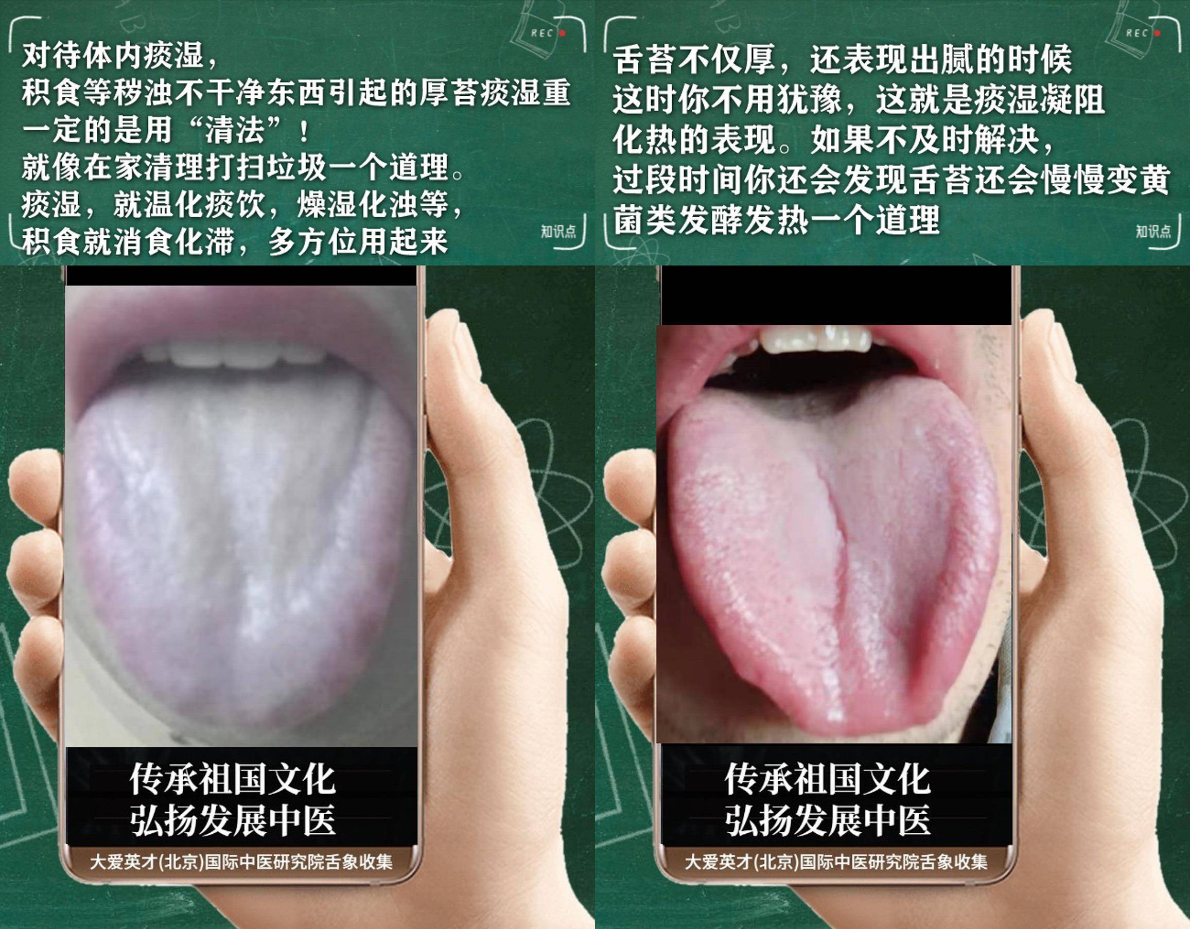 中医解剖:容易心慌出虚汗,头身重困,气阴两虚_mmhg_分析_参考