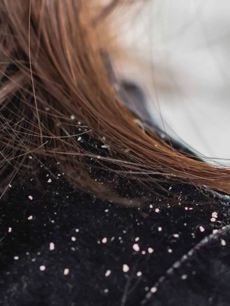 头皮痒,头屑掉?赶快来靓津津洗护抄作业!一招都解决_公司_去屑_互联网