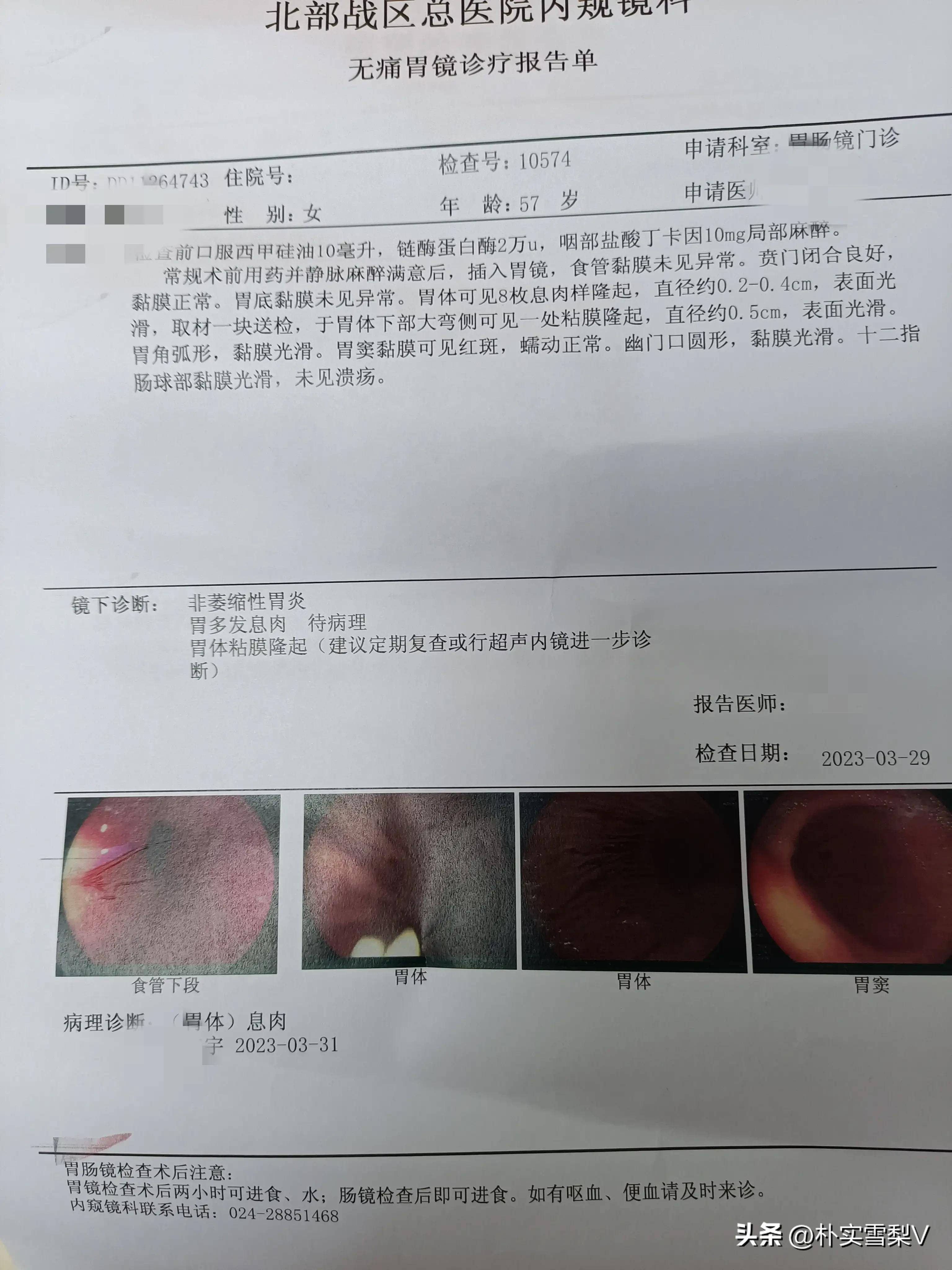 胃息肉像割韭菜一样总是复发,尽管怕做胃肠镜检查,但我更怕伤_老公