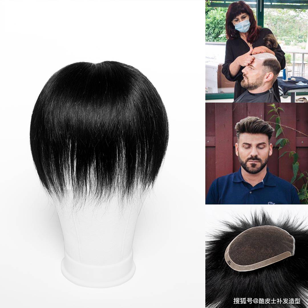 长期戴假发会对头皮有伤害吗?_头发_影响_护理