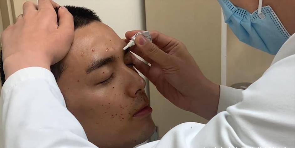 吴磊拍戏意外烫伤!