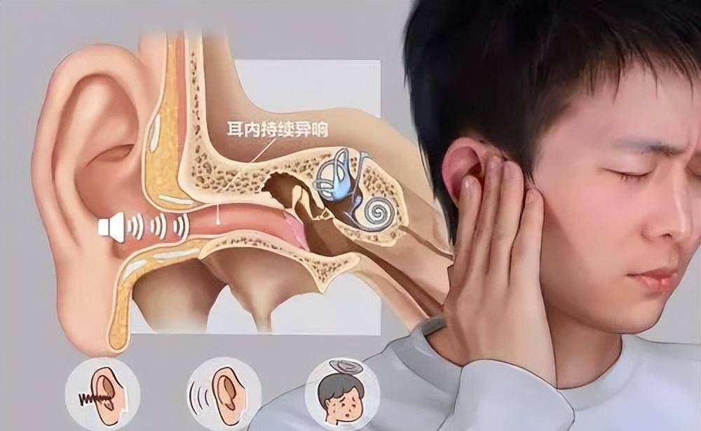 突然出现耳鸣,耳聋是怎么回事?_治疗_其原因_疾病