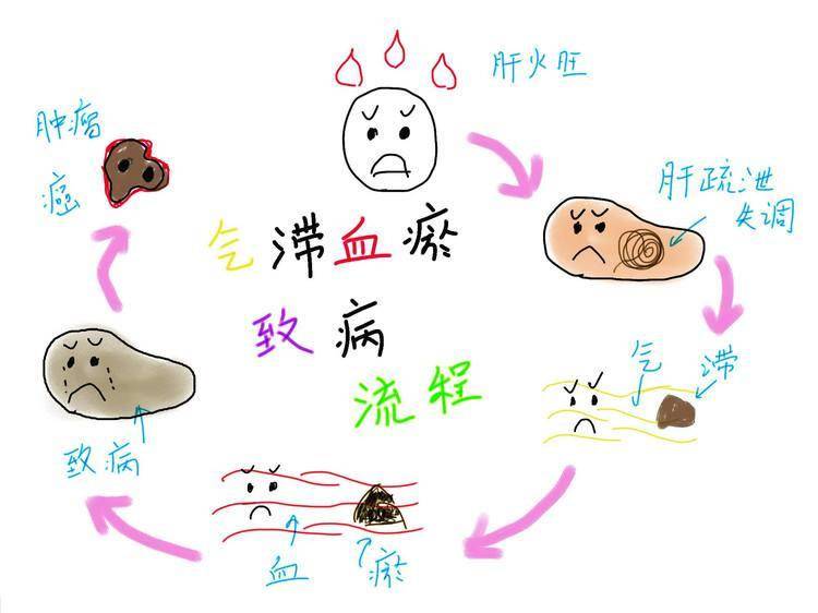 原创            常按三个穴位，行气祛湿化瘀，清除一切“淤堵”，消散全身结节(祛湿气最好的方法目前最有效的)