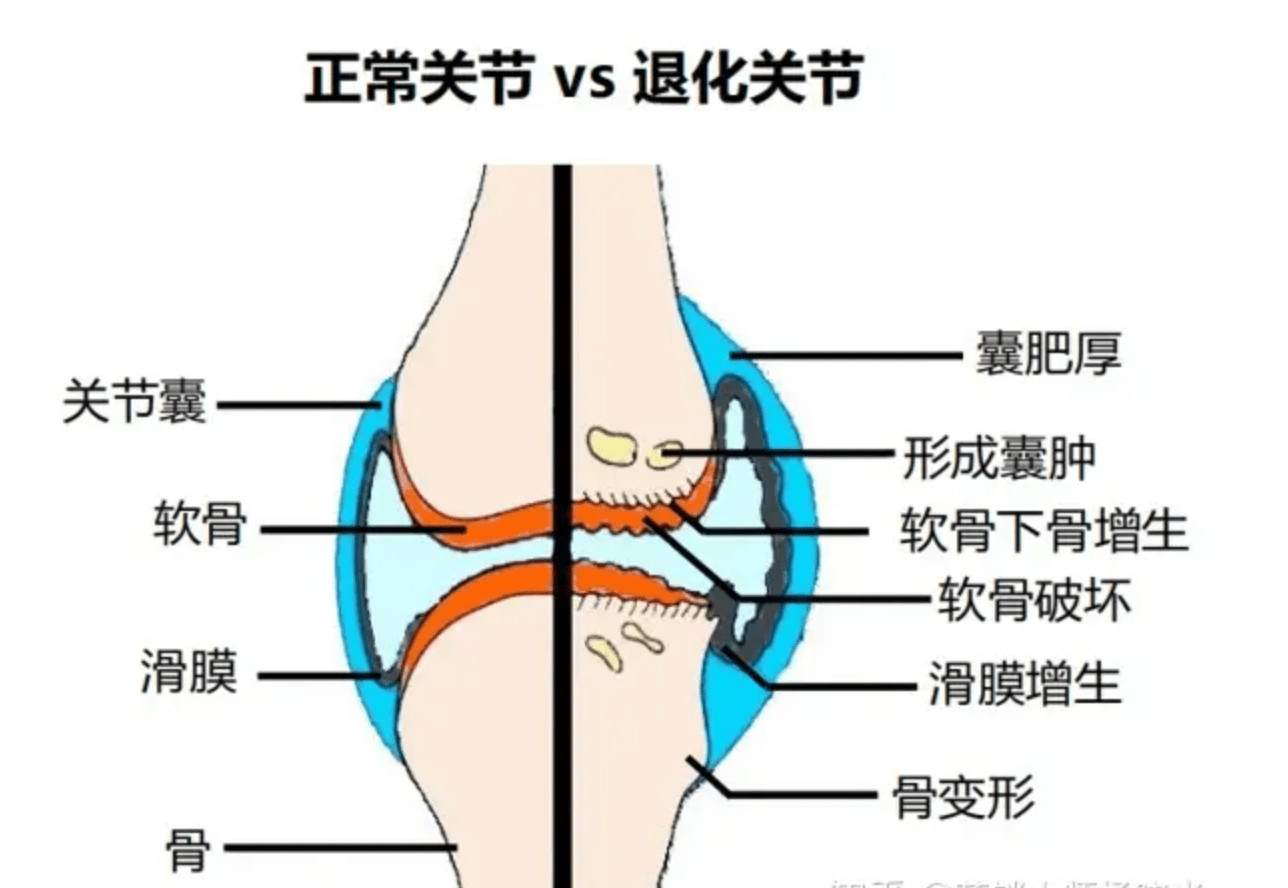 膝关节滑囊位置图图片