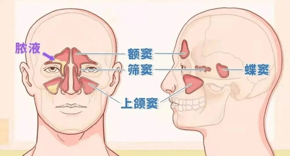 鼻炎构造解剖图图片