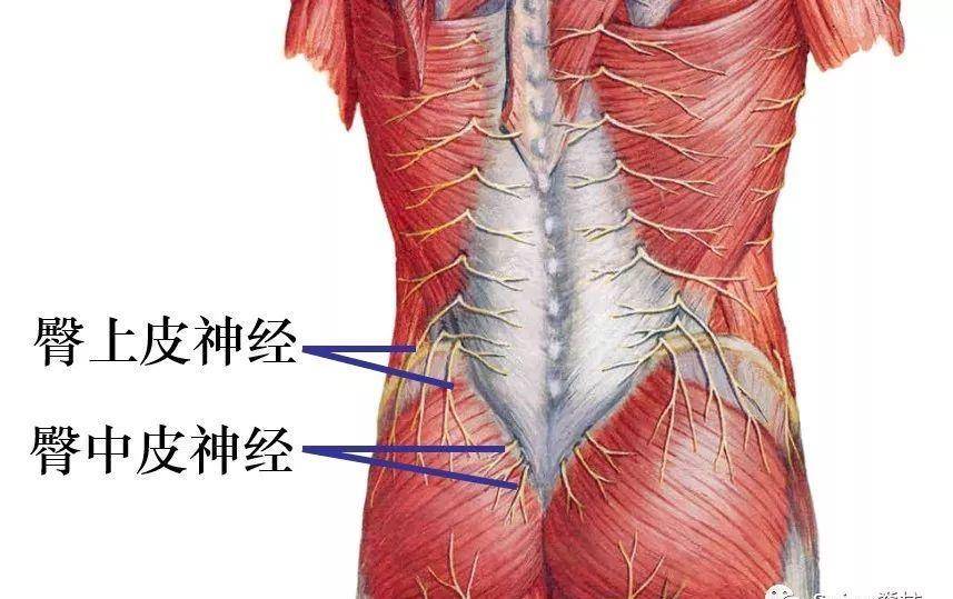 臀上皮神经卡压综合征