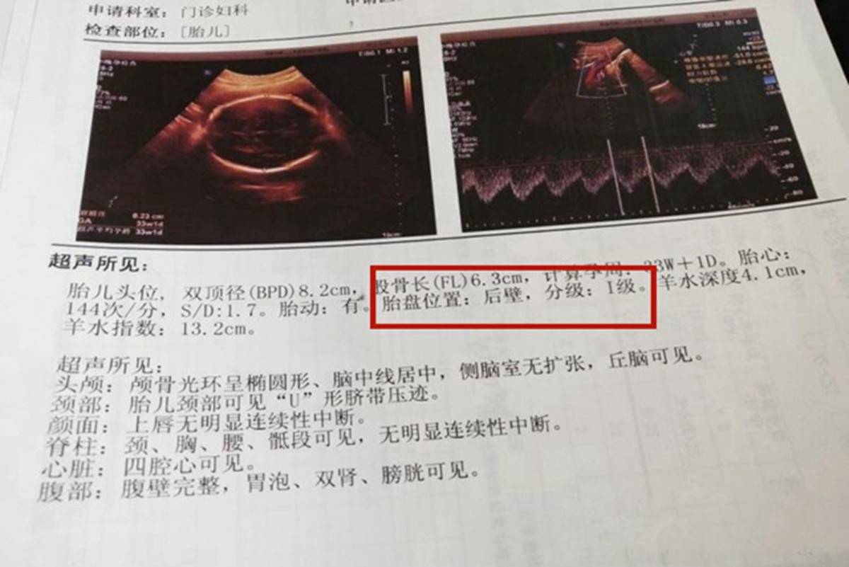 孕妇b超单数据怎么看？这2个数准妈妈一定要会看