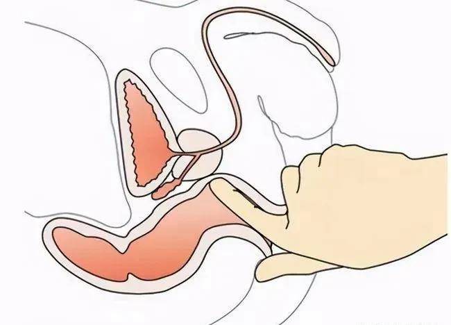 正常的肛门检查图片