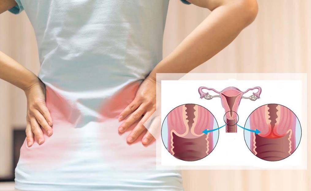 女性经期腰频繁疼痛,或是这4种妇科疾病在捣乱!要注意提高重视