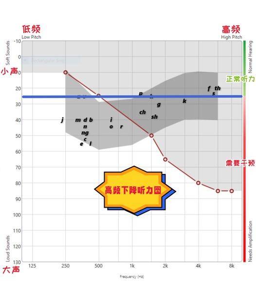 这个曲线图的术语是听力图