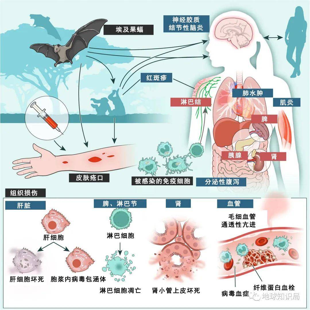 马尔堡病毒吐内脏图片