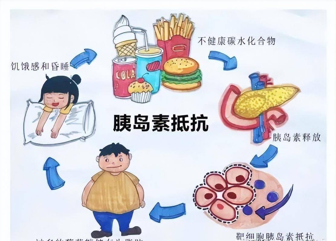 朋友说她有胰岛素抵抗了_发展_感觉_细胞